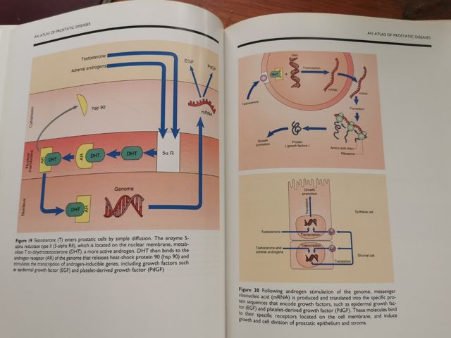 An Atlas of Prostatic Diseases (Ingles)