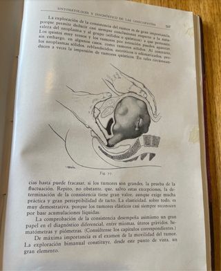 Vecchio libro di medicina 1929 organi, donna