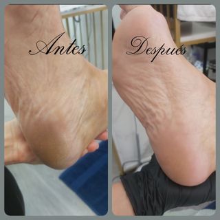 Pedicura Completa Tradicional 