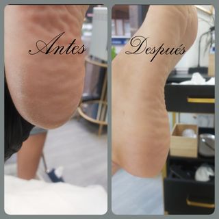 Pedicura Completa Tradicional 