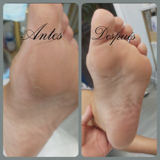 Pedicura Completa Tradicional 
