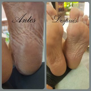 Pedicura Completa Tradicional 