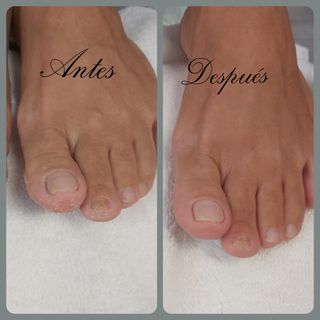 Pedicura Completa Tradicional 