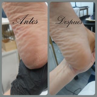 Pedicura Completa Tradicional 