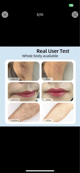 Epilator