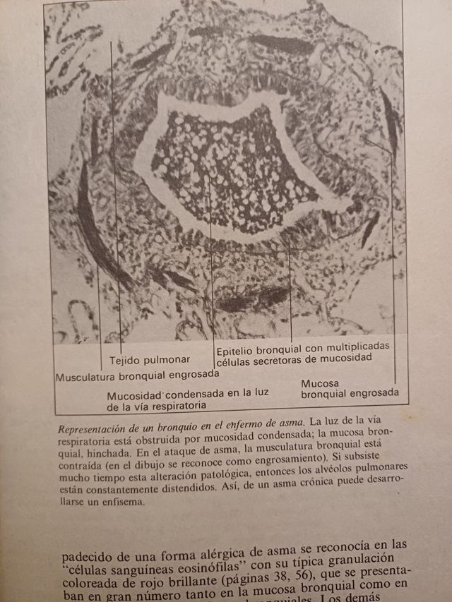 Consulta médica ASMA