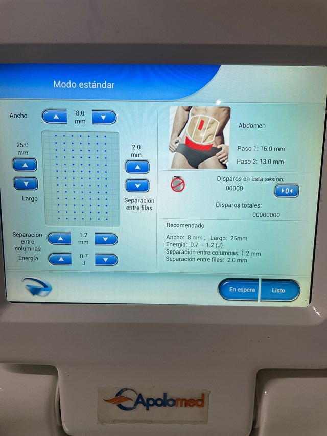 HIFU (ultrasonido enfocado de alta intensidad)