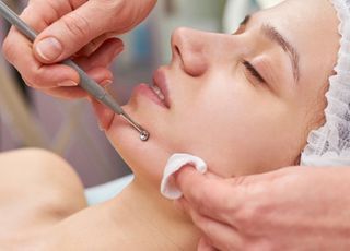 LIMPIEZA FACIAL PUNTA DIAMANTE 💎LUZ LED
