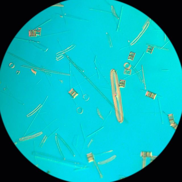 Olympus IMT-2 Microscopio DIC Nomarski Invertido