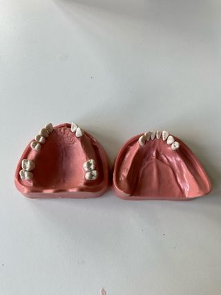 Tipodonto edéntulo parcial prótesis KAVO