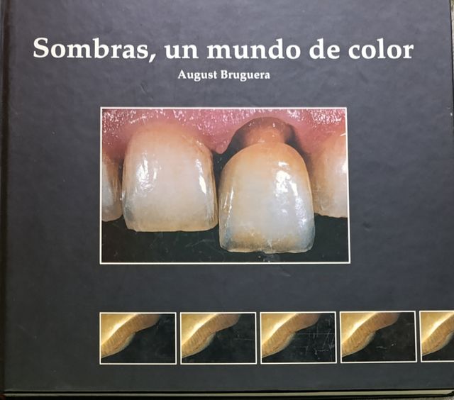 Libro de prótesis dental