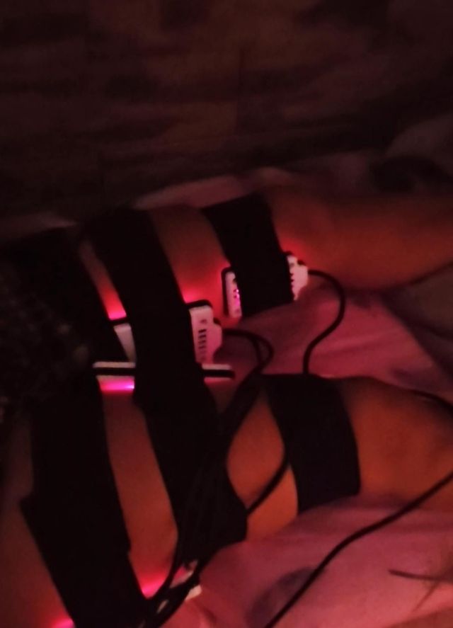 Sección de criolipolosis y lipolaser