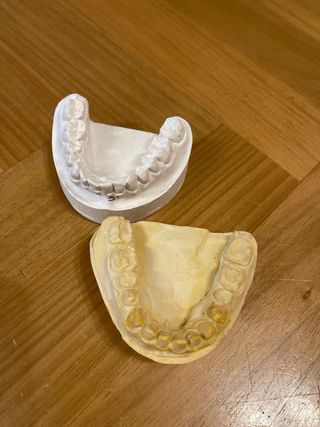9 Modelos escayola para encerar Prótesis Dental