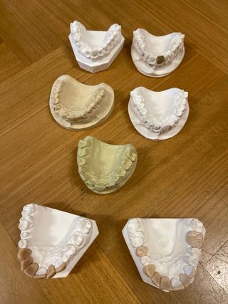 9 Modelos escayola para encerar Prótesis Dental