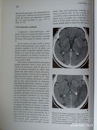 Manuale Di Neurologia Clinica