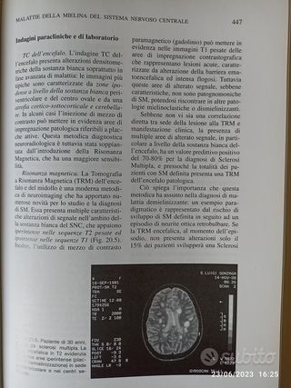 Manuale Di Neurologia Clinica