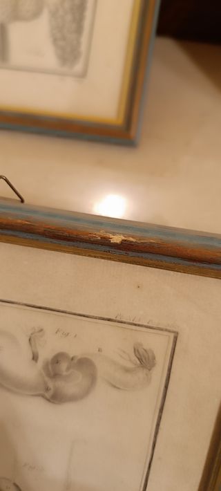 4 Quadri illustrazioni anatomia Umana 