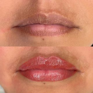 micropgimentacion de labios