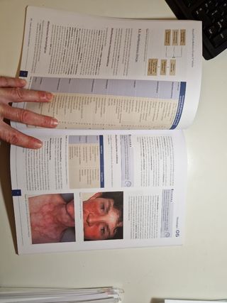 Manual CTO de Medicina y Cirugía 9ª ED - Reumatolo