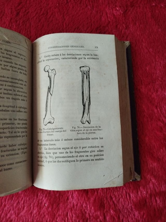 Los VENDAJES y los apósitos de fracturas