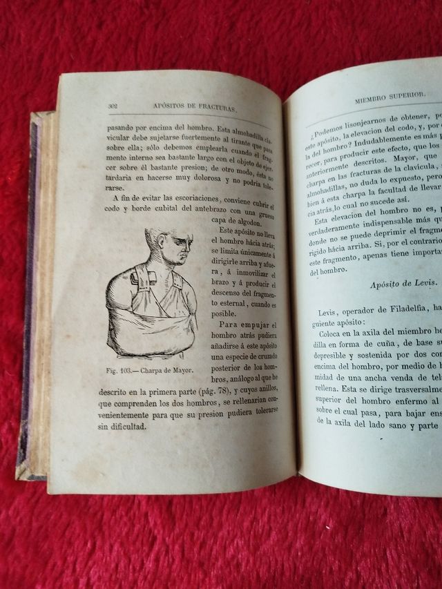 Los VENDAJES y los apósitos de fracturas