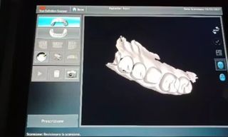 3m tre definituon scanner