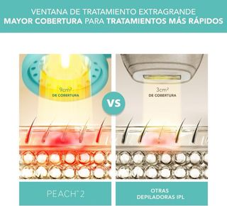 Depiladora IPL FOREO