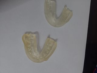 Paradenti in silicone modellabile