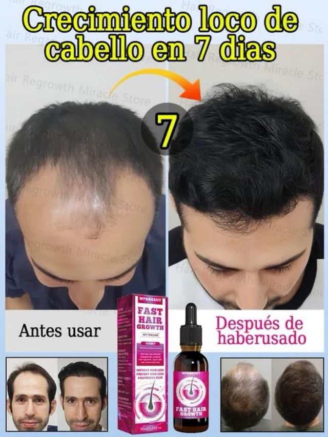 Fast hair growth