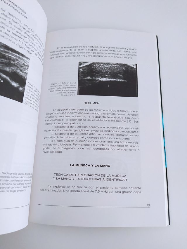 Ecografía del aparato locomotor