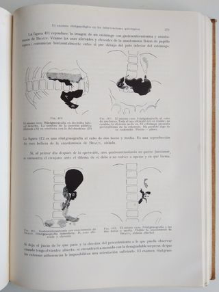 Medicina Antigua 1931 E.Stierlin