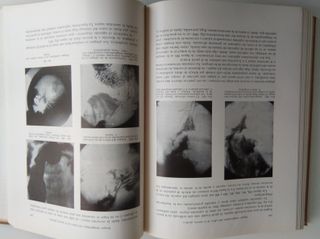 Medicina Antigua 1931 E.Stierlin