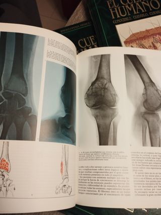 Enciclopedia Médica Familiar El Cuerpo Humano