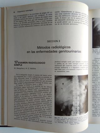 Medicina Antigua 1976 Diagnóstico Radiológico
