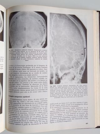Medicina Antigua 1976 Diagnóstico Radiológico