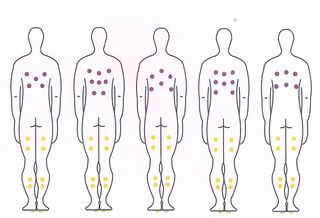 Spa jacuzzi exterior Harmony