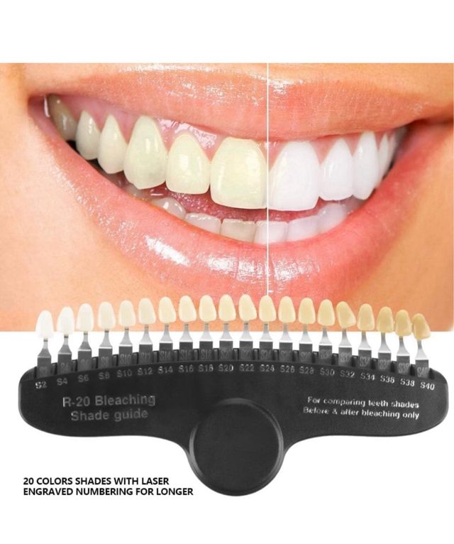 Guida ai colori dentali