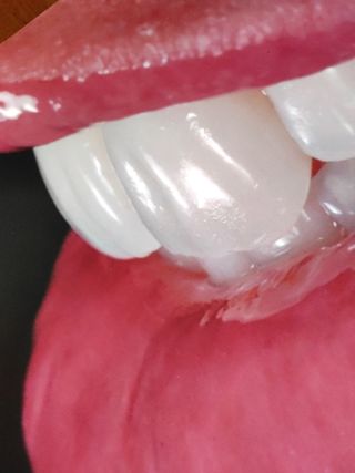 2x1libros Atlas estética dental