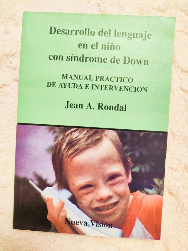 EL NIÑO con SÍNDROME DE DOWN