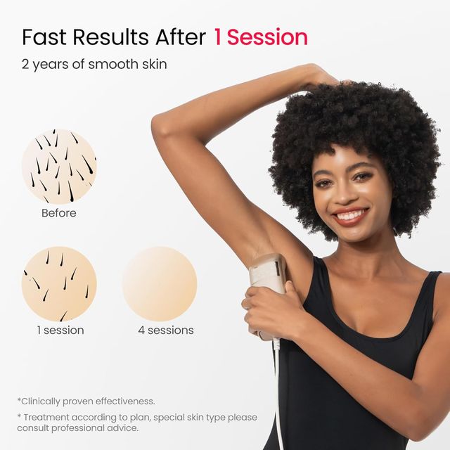 Epilatore laser professionale IPL Quad Pulse