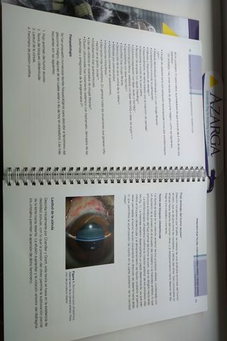 Glaucomas secundarios