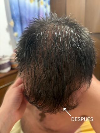 LOCIÓN ANTICAIDA NATURAL VEGANA