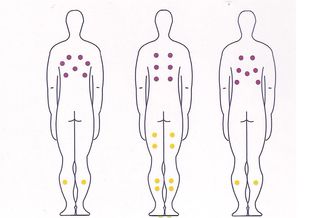 Spa jacuzzi exterior Adagio Plus