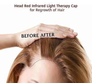 Gorro de terapia para caida