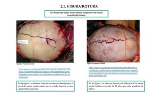 APUNTES ANATOMÍA PATOLÓGICA Y CITODIAGNÓ