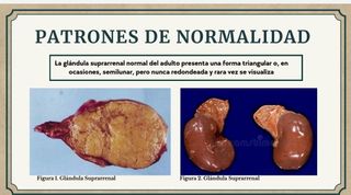 APUNTES ANATOMÍA PATOLÓGICA Y CITODIAGNÓ