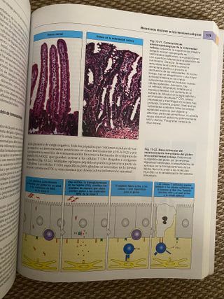 INMUNOBIOLOGIA JANEWAY