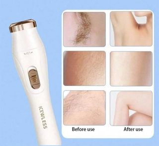 Kit elettrico 3 in 1 per rimozione dei peli