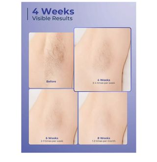 NUEVA Depiladora luz pulsada