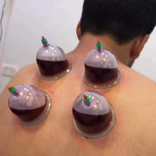 Alhijama